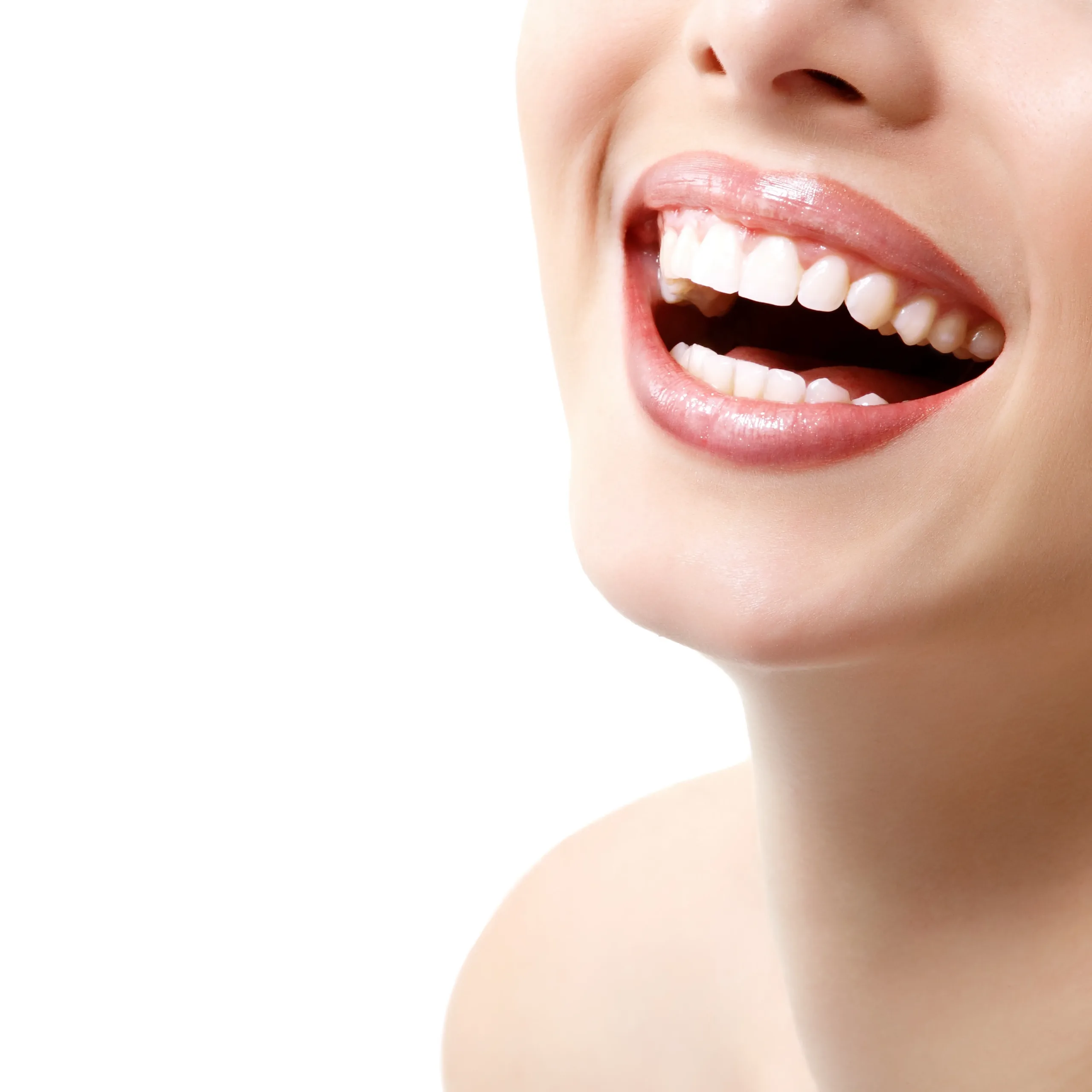 blanqueamiento dental en talavera de la reina creta imagen