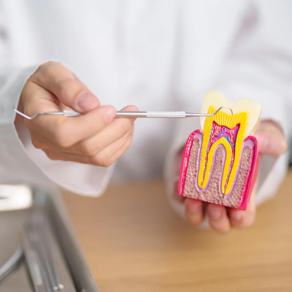 endodoncia centro dental creta