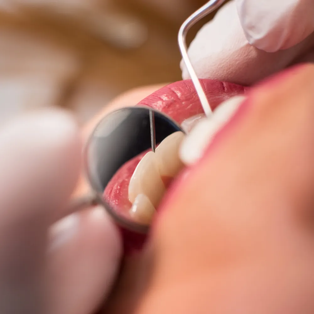 endodoncia en talavera de la reina creta