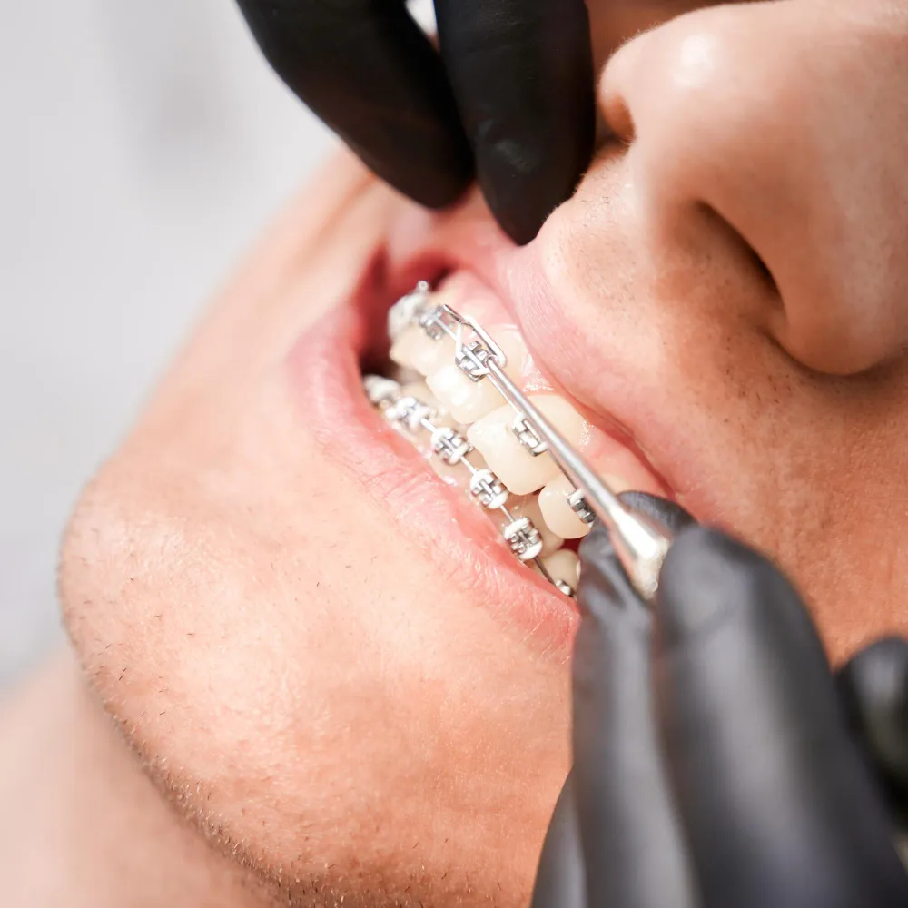 ortodoncia en talavera de la reina centro dental creta imagen