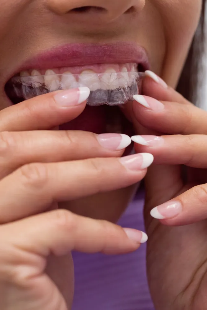 ortodoncia en talavera de la reina centro dental creta